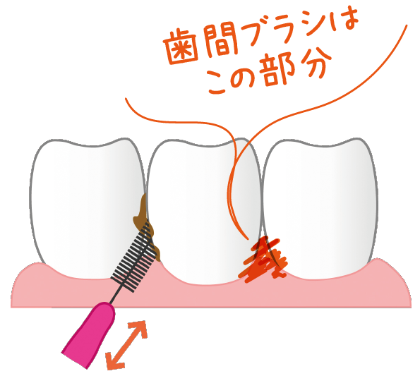 歯間ブラシの頻度はどれほどが最適 正しい使い方を伝授 Hamigaki Life